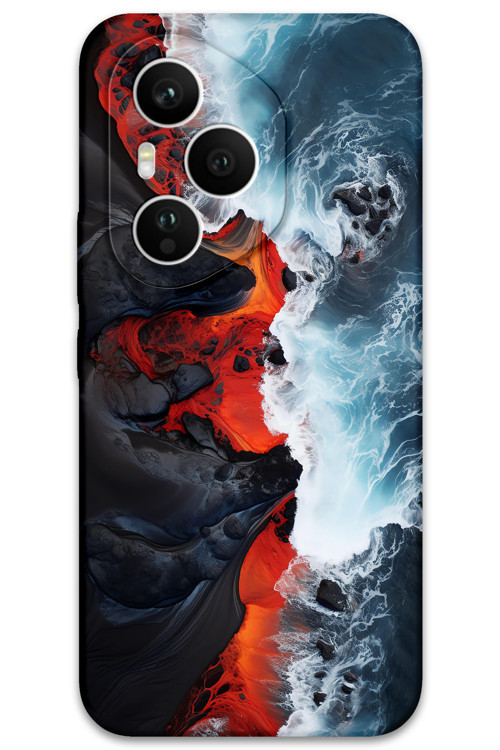 Honor 400 Pro Uyumlu Mermer Desenli Telefon Kılıfı + Ekran Koruyucu - 5811