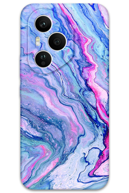 Honor 400 Pro Uyumlu Mermer Desenli Telefon Kılıfı + Ekran Koruyucu - 5816