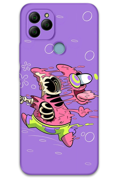 Gm 21 Uyumlu Sünger Bob Desenli Telefon Kılıfı + Ekran Koruyucu - 5939