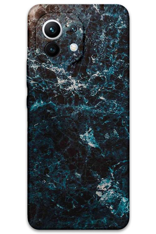 Xiaomi Mi 11 Uyumlu Mermer Desenli Telefon Kılıfı + Ekran Koruyucu - 5819