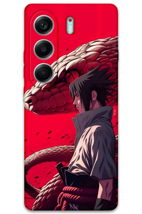 Tecno Camon 40 Pro 5G Uyumlu Anime Desenli Telefon Kılıfı + Ekran Koruyucu - 5746