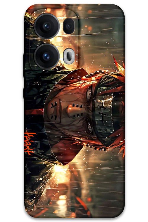 Oppo Reno 13 Pro 5G Uyumlu Anime Desenli Telefon Kılıfı + Ekran Koruyucu - 5925