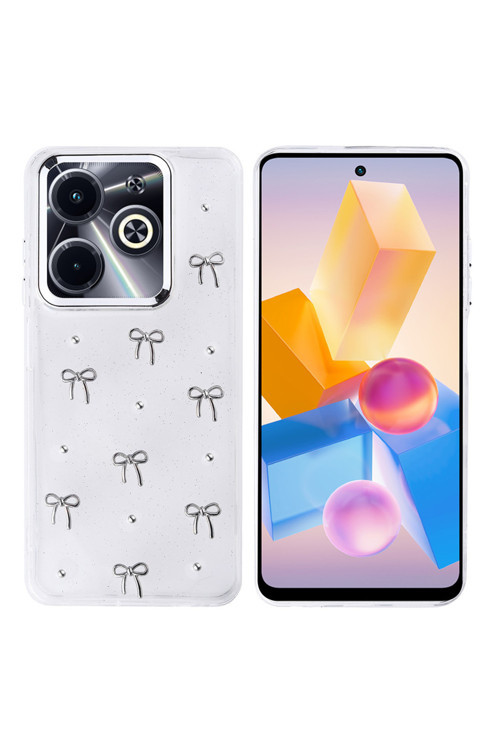 İnfinix Hot 40İ Kılıf Simli Desenli Kapak Zr-Kutup