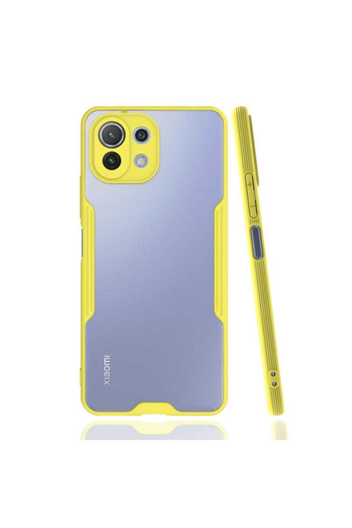 Xiaomi Mi 11 Lite Kılıf Ultra İnce Buzlu Zr-Parfe
