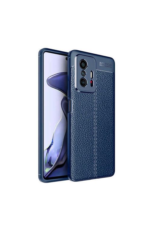 Xiaomi Mi 11T 5G Kılıf Deri Görünümlü Silikon Zr-Niss