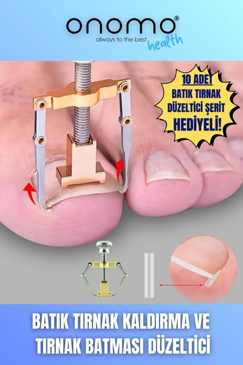 Health Batık Tırnak Düzeltici Batık Tırnak Çıkartıcı Aparat Ve Batma Engelleyici Çubuk