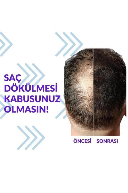 Pak Darou Minioxidil Minoxidil %5 Minoksil Pak Darou 2 ADET