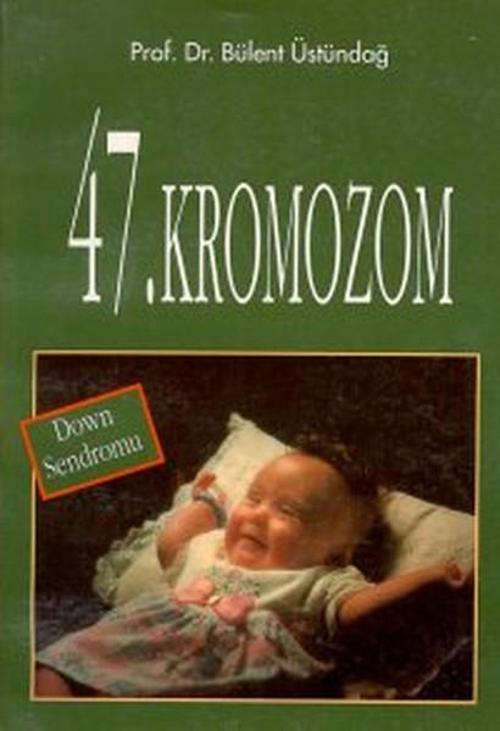 47. Kromozom Down Sendromu