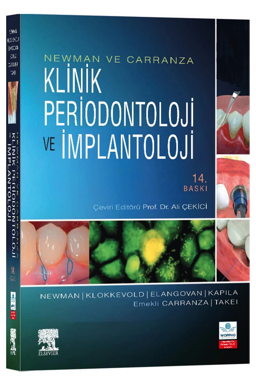 Newman ve Carranza Klinik Periodontoloji ve İmplantoloji 14. Baskı