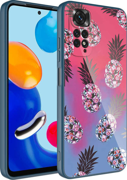 Redmi Note 11S Global Kılıf Kamera Korumalı Desenli Sert Silikon MSRA Epoksi Kapak - NO3