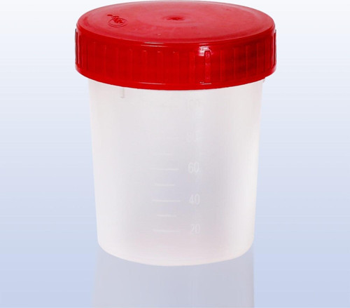 Idrar Numune Kabı Kırmızı 250 Adet 100 Ml