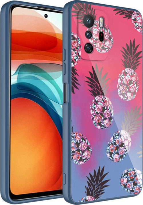 Redmi Note 10 Pro Kılıf Kamera Korumalı Desenli Sert Silikon Klfs Epoksi Kapak - No3