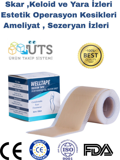 Soft Silikon Bant - Ameliyat Izi Giderici - Sezaryen - Yanık - Estetik 4Cm X 1,5Mt