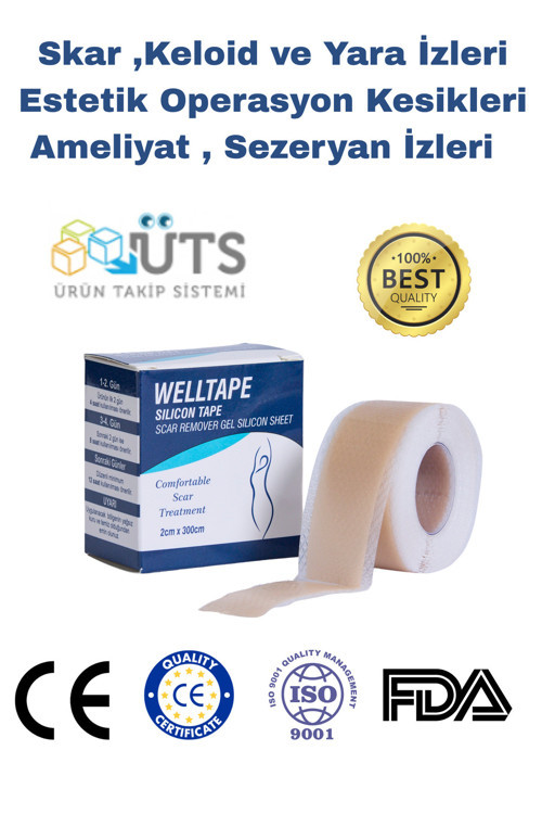 Soft Silikon Bant - Ameliyat İzi Giderici - Sezaryen - Yanık -Keloid- Estetik 2Cm X 3M