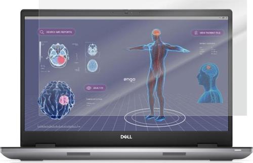 Dell Precision 7780 17.3 inç Mat Ekran Koruyucu Şeffaf