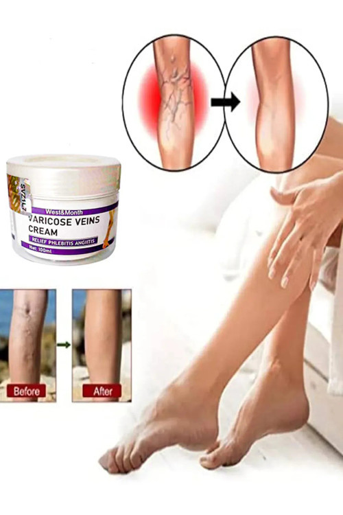 No35 Cream West&Month Selülit Karşıtı Bacak Önleyici Bakım Kremi 100 Ml X 2 Adet