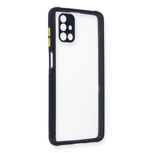 Samsung Galaxy M51 Kılıf Miami Şeffaf Silikon - Lacivert