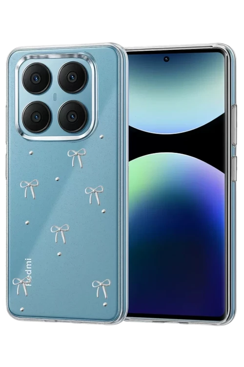 Newface Xiaomi Redmi Note 14 Pro 4G Fiyonk Desenli Kapak - Desen 5