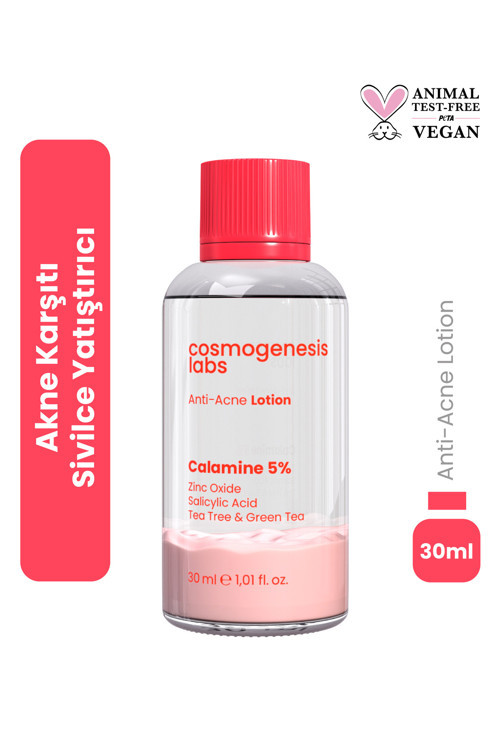 Akne Önleyici Kurutucu Losyon 30Ml – Yatıştırıcı Siyah Nokta Azaltıcı Vegan (%5 Kalamin - Yeşil Çay)