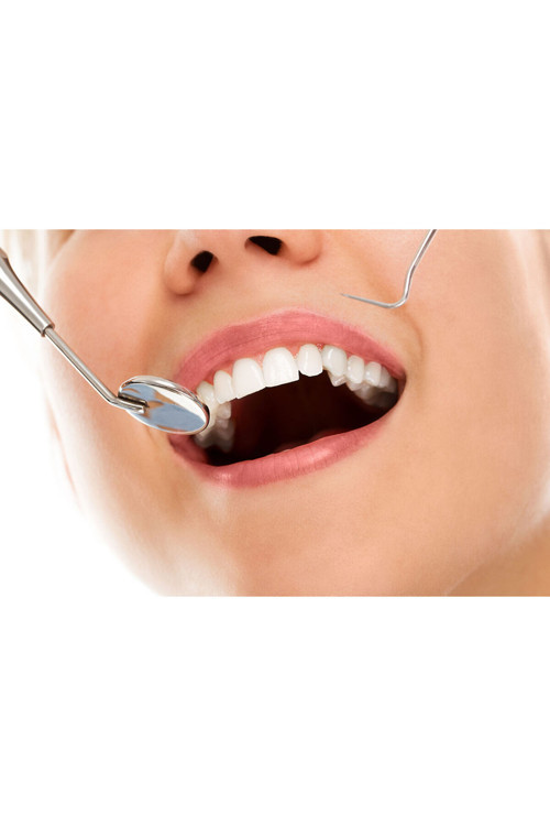 Dentist-Scaled Diş Kanvas Tablo