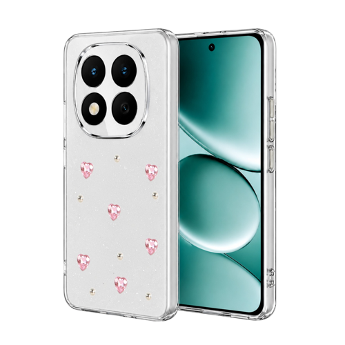 Xiaomi Redmi Note 15 Pro Plus 5G Fiyonk Desenli Kapak - Desen 3