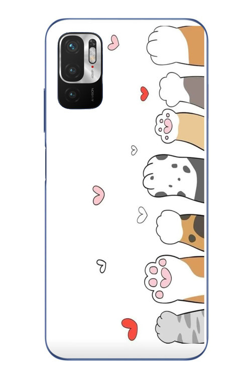 Redmi Note 10 5G Uyumlu Kedi Harekatı Patileri Baskılı Silikon Kılıf