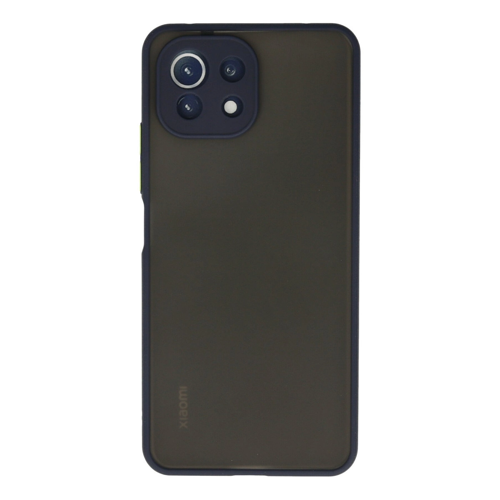 Mi 11 Lite Montreal Kapak - Lacivert