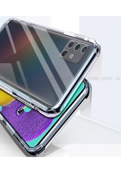 Samsung A71 Kılıf Kamera Korumalı Soft Tıpalı Silikon Kılıf