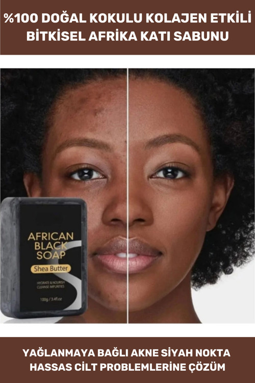 100% Doğal Vücut El Yüz Saç Güzel Kokulu Cilt Onaran Kolajen Etkili Afrika Bitkisel Sabun 1 Adet