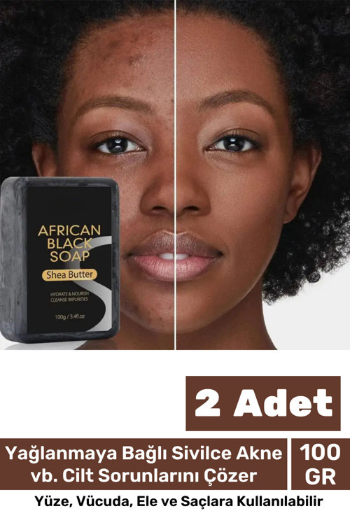 100% Doğal Güzel Kokulu El Yüz Saç Vücut Cilt Onaran Kolajen Etkili Afrika Bitkisel Sabun 2 Adet