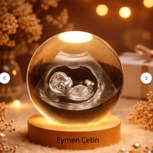 Kişiye Özel 3D Ultrason Bebek Görüntüsü Kristal Cam Küre