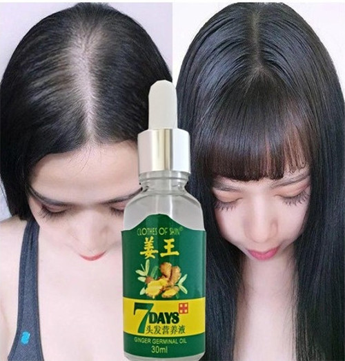 7Days 30Ml Gingergerminalessentialoil Hair Growth Loss Treatment Unisex 3 Adet Saç Bakım Yağı