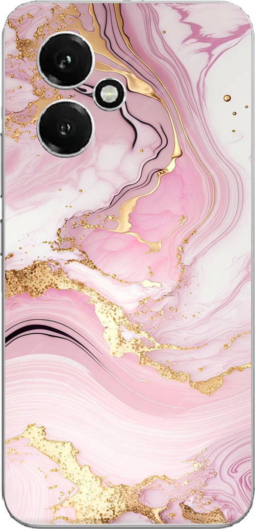 Honor 400 Uyumlu Pembe Mermer Baskılı Silikon Kılıf