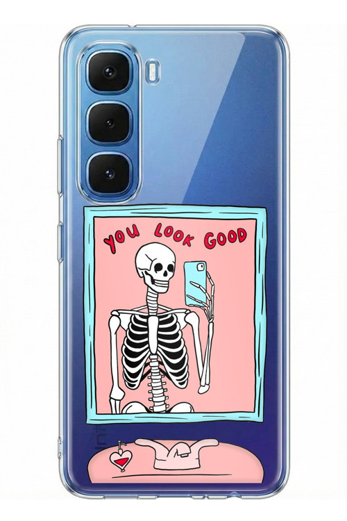 Infinix Hot 60 - Hot 60i Uyumlu You Look Good İskelet Tasarımlı Baskılı Silikon Kılıf