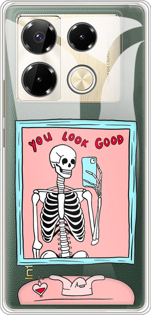 Infinix Note 40 PRO Uyumlu You Look Good İskelet Tasarımlı Baskılı Silikon Kılıf