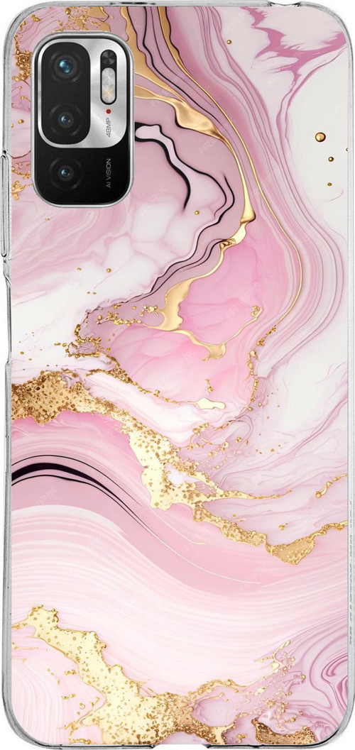 Redmi Note 10 5G Uyumlu Pembe Mermer Baskılı Silikon Kılıf