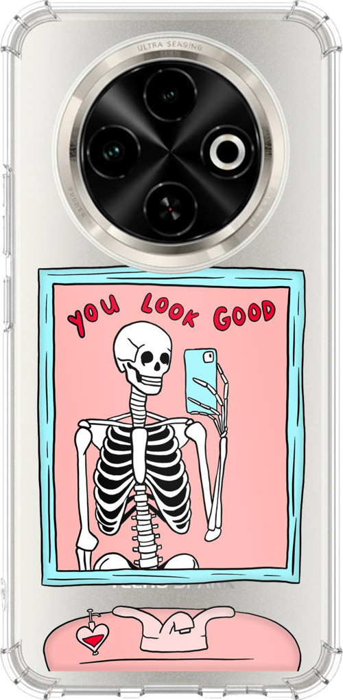 Tecno Spark 30C Uyumlu You Look Good İskelet Tasarımlı Baskılı Silikon Kılıf