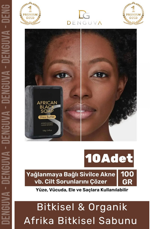 100% Doğal Güzel Kokulu El Yüz Saç Vücut Cilt Onaran Kolajen Etkili Afrika Bitkisel Sabun 10 Adet