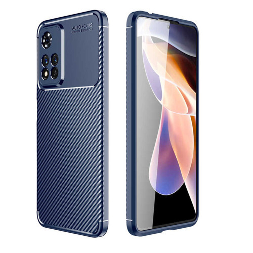 Xiaomi Redmi Note 11 Pro Plus 5G Kılıf Karbon Görünümlü Silikon Kamera Korumalı Üstün Koruma