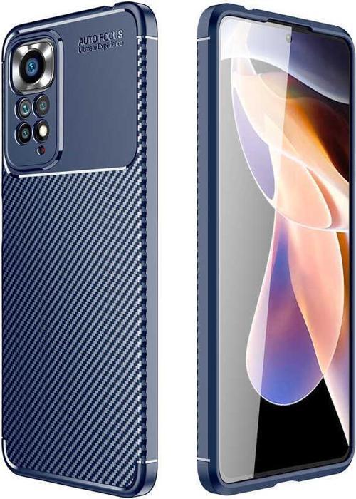 Xiaomi Redmi Note 11S Global Kılıf Darbe Emici Parmak İzi Yapmaz Karbon Tasarım Negro Silikon Kılıf