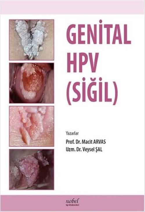 Genital HPV (Siğil)
