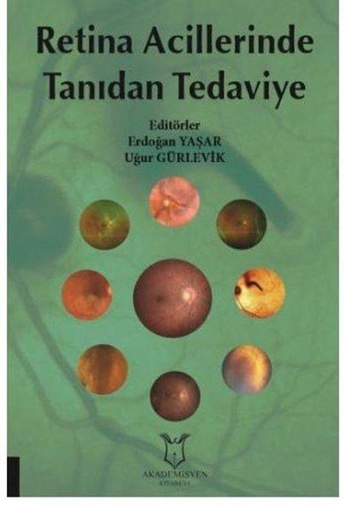 Retina Acillerinde Tanıdan Tedaviye