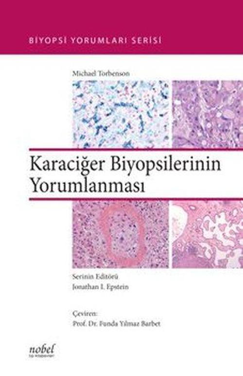 Biyopsilerin Yorumu: Karaciğer