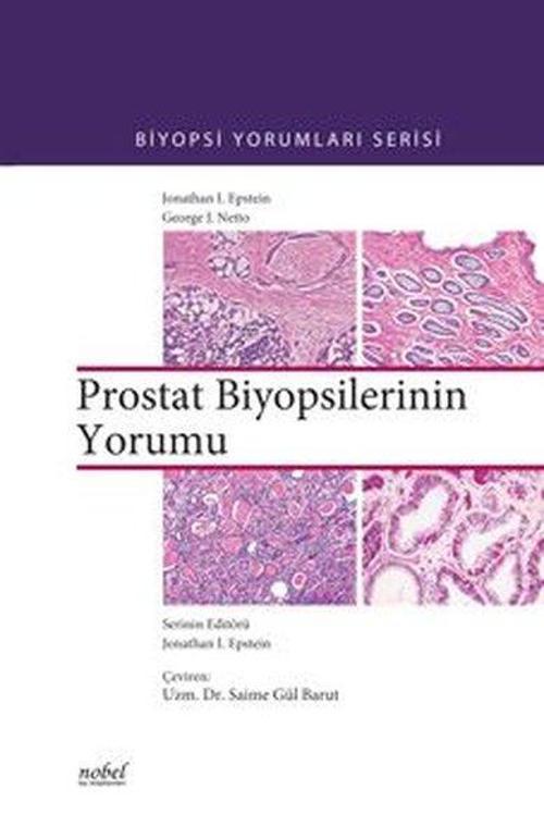 Biyopsilerin Yorumu: Prostat