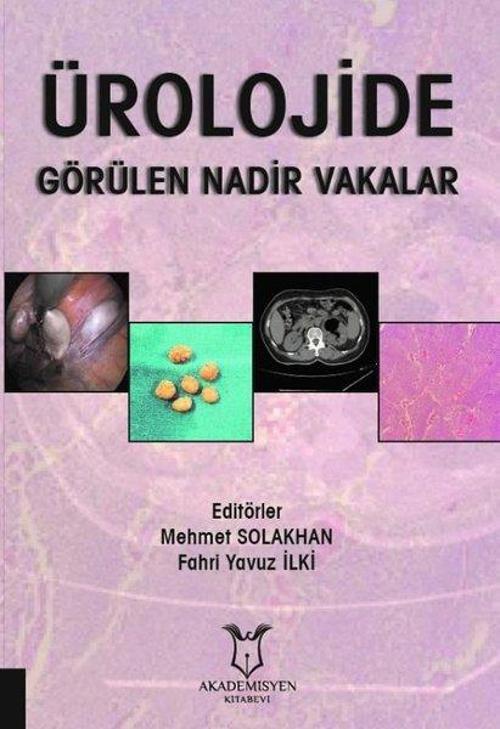 Ürolojide Görülen Nadir Vakalar