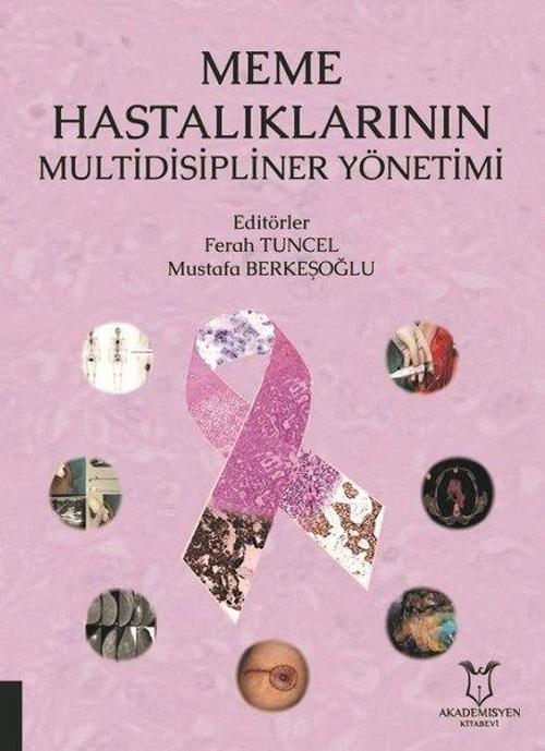 Meme Hastalıklarının Multidisipliner Yönetimi