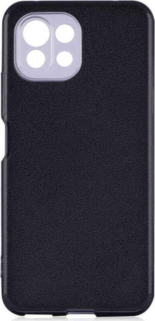 Xiaomi Mi 11 Lite Simli Ve Parlak Şık Shining Premium Silikon Kılıf