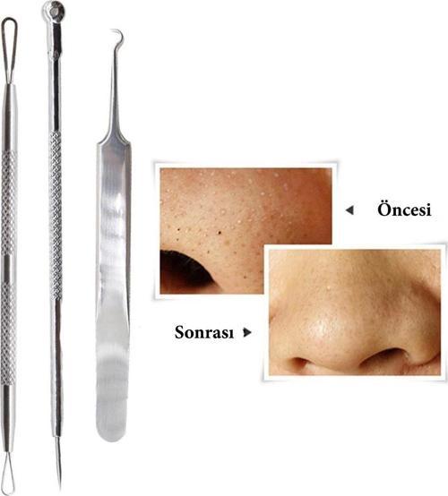 Paslanmaz Çelik Siyah Nokta Sivilce Ve Akne Temizleyici Set 3'lü Kit