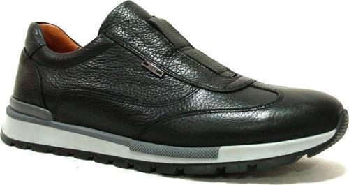 Siyah Lastikli Bağcıksız Anatomik Comfort Ayakkabı