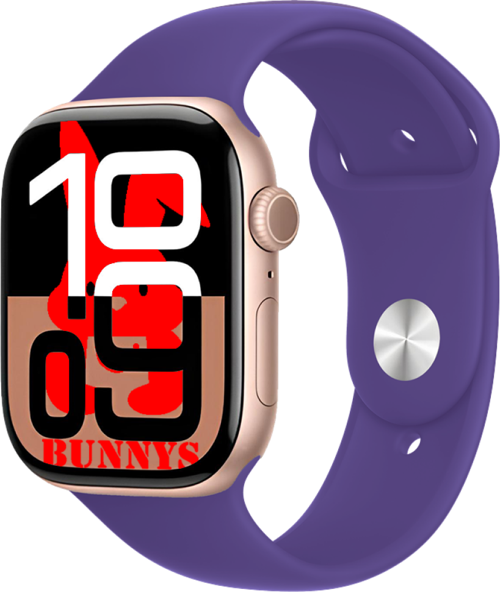 Omix X700 Uyumlu KoyuMor Akıllı Saat Watch10 2025 Hediyeli AMOLED EKRAN